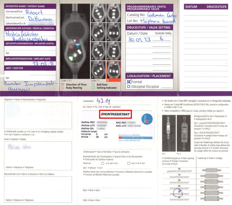 VP-Shunt Assistent – Failed